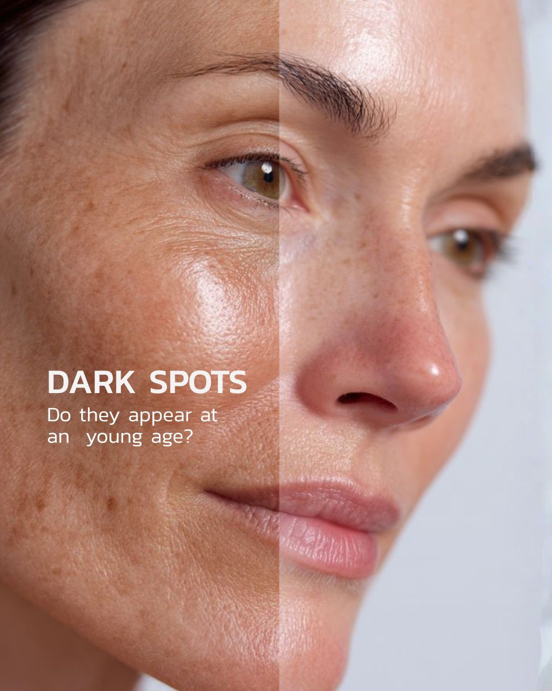 Women’s Dark Spot Correcting Serum