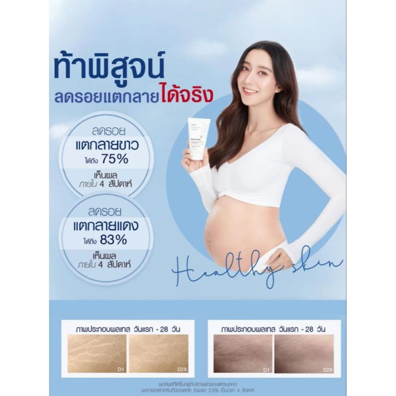 Mom Nursing Cream 250 gm